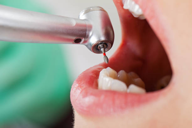 Best Emergency Denture Repair in Powder Springs, GA